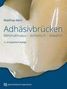 Matthias Kern: Adhäsivbrücken, Buch