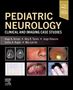 Alcy R. Torres: Pediatric Neurology, Buch