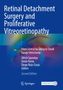 Retinal Detachment Surgery and Proliferative Vitreoretinopathy, Buch