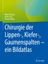 Marco Kesting: Chirurgie der Lippen-, Kiefer-, Gaumenspalten - ein Bildatlas, Buch