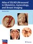 Eberhard Merz: Atlas of 3D/4D Ultrasound in Obstetrics, Gynecology, and Breast Imaging, Buch
