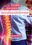 Lukas Hoffmann: Kleiner Ratgeber Spinalkanalstenose, Buch