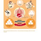 Diagramm zum Thema Diabetes mit Pfeilen, Organen und Personen. Begriffe wie Insulingabe, Glukagon, Essen, Blutzuckerspiegel.