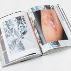 Große Nahaufnahme: eine Narbe auf der Haut, daneben Kunstwerk in schwarzen und weißen Wirbeln. Oberer Rand enthält Text.