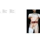 Verletzungen. Sammlung DASA, Dortmund, Deutschland, 1995. Statue mit Gurt um den Oberkörper, Bein in Gips.