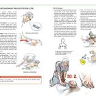 Anleitung zur kardiopulmonalen Reanimation (CPR) mit Illustrationen: Bewusstsein prüfen, Atmung überprüfen, CPR-Technik.