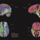 "Bahn im Gehirn" links, "Handlungs-planungsareal" rechts. Visualisierung von Nervenbahnen in bunten Farben durch das Gehirn.