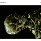 "Schädel mit brennender Zigarette", Januar-Februar 1886, Antwerpen. Gemälde eines rauchenden Schädels in dunklen Tönen.