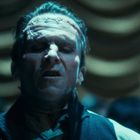 Ein Mann mit geschlossenen Augen, Nähte auf der Stirn. Der Hintergrund ist verschwommen und zeigt Vorhänge.