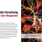 Alzheimer: Neueste Forschung gegen das Vergessen. Illustration zeigt Nervenzellen und amyloide Ablagerungen im Gehirn.
