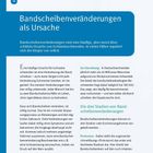 Bandscheibenveränderungen als Ursache. Häufige Ursachen für Ischiasbeschwerden sind Veränderungen der Bandscheiben.