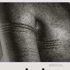 507019445-3643e97e19-o.JPG. Schwarz-weiß, Haut mit mehreren parallelen Linien oder Falten. Dunkle Texturen sichtbar.