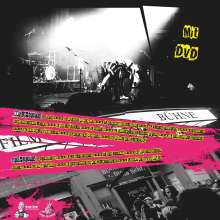 Kollektiver Brechreiz: Live in Leipzig (Limited Edition), 1 LP und 1 DVD