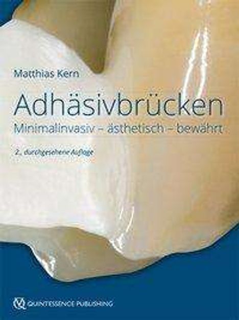 Matthias Kern: Adhäsivbrücken, Buch
