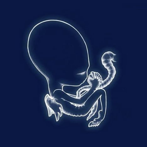 Sigur Rós: Agaetis Byrjun, 2 LPs