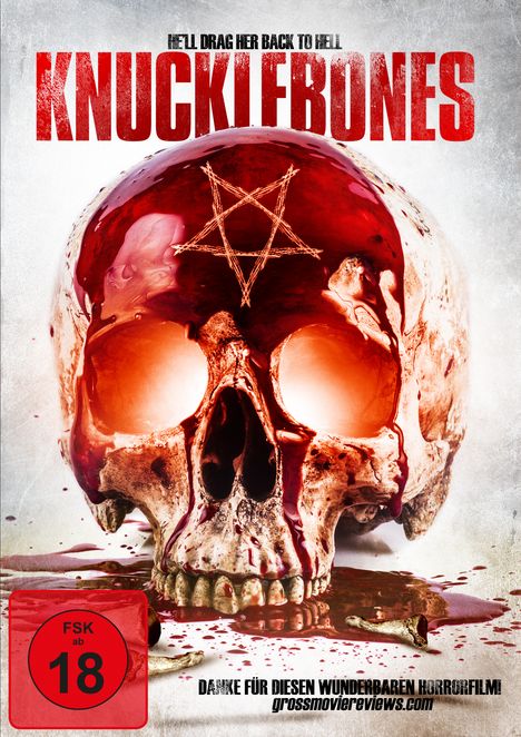 Knucklebones, DVD