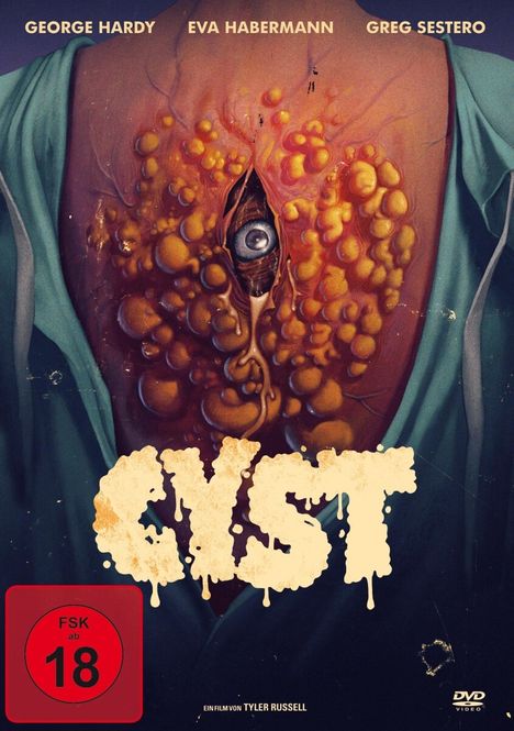 CYST, DVD