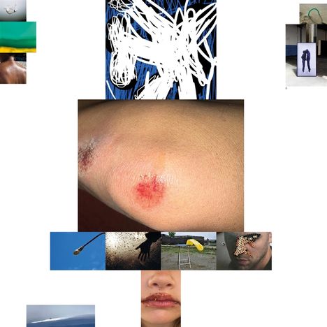 Kratzspur auf einem Ellenbogen, umgeben von kleinen Fotos, darunter ein Gesicht mit einer seltsamen Textur auf der Nase.