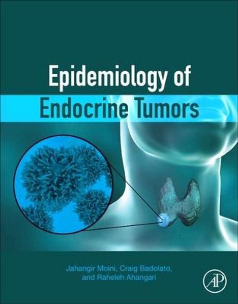 Jahangir Moini: Epidemiology of Endocrine Tumors, Buch