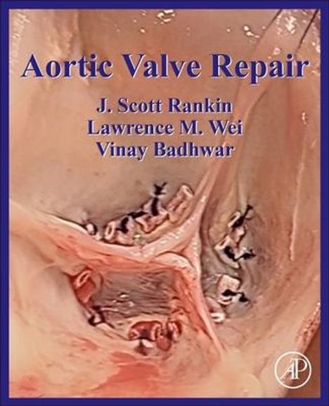 J Scott Rankin: Aortic Valve Repair, Buch