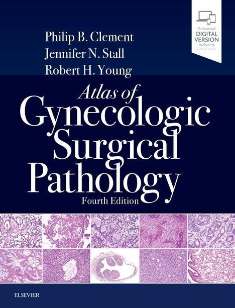 Philip B. Clement: Atlas Of Gynecologic Surgical, Buch