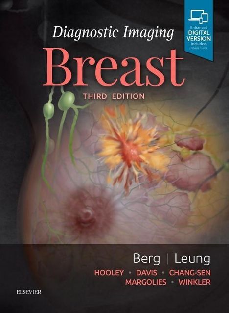 Wendie A Berg: Diagnostic Imaging: Breast, Buch