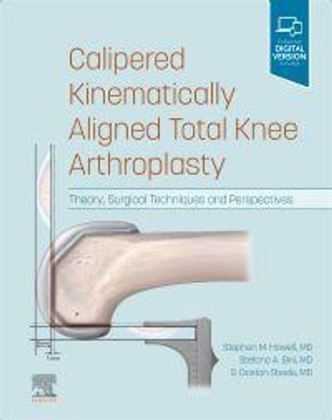 Stephen M Howell: Calipered Kinematically Aligned Total Knee Arthroplasty, Buch