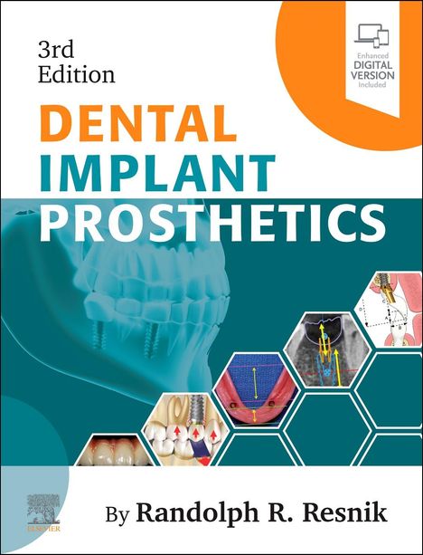 Randolph Resnik: Dental Implant Prosthetics, Buch