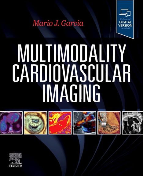 Multimodality Cardiovascular Imaging, Buch