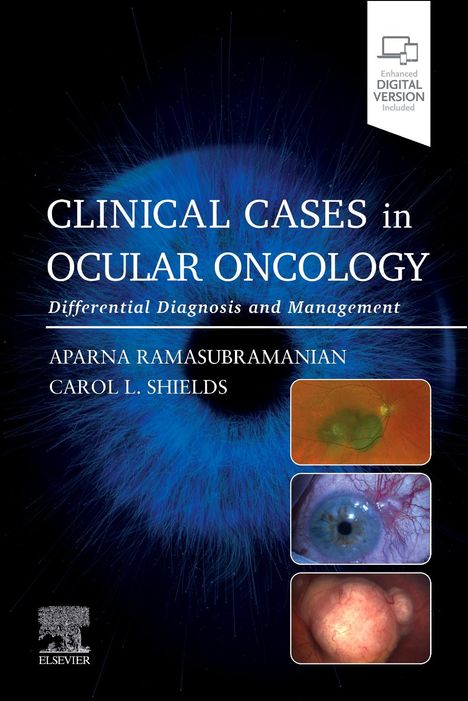 Clinical Cases in Ocular Oncology, Buch