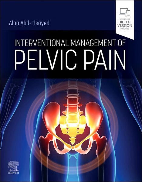 Interventional Management of Pelvic Pain, Buch