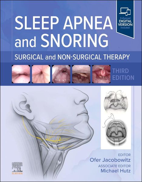 Sleep Apnea and Snoring, Buch
