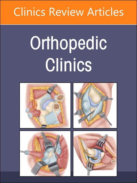 Perioperative Risks in Orthopedics, an Issue of Orthopedic Clinics, Buch