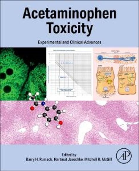 Acetaminophen Toxicity, Buch