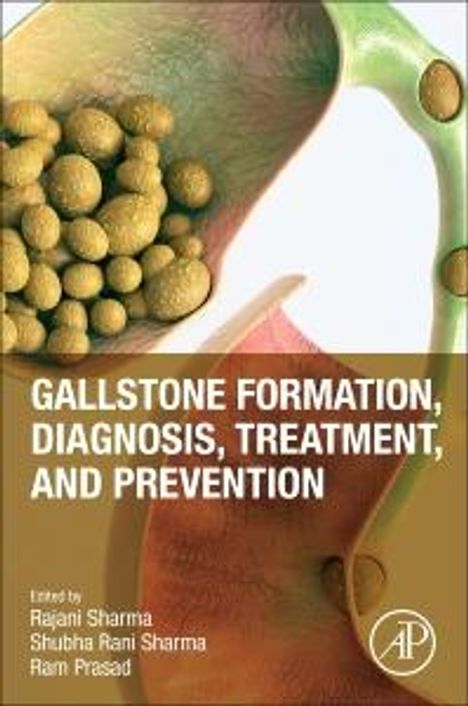 Gallstone Formation, Diagnosis, Treatment and Prevention, Buch