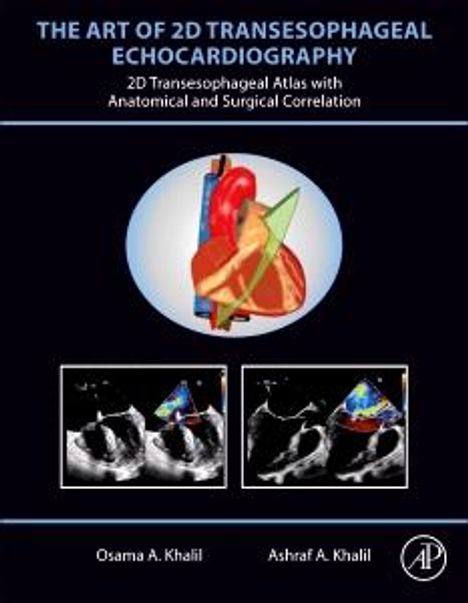 Osama A Khalil: The Art of 2D Transesophageal Echocardiography, Buch