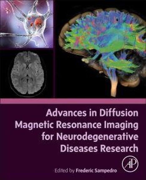 „Advances in Diffusion Magnetic Resonance Imaging for Neurodegenerative Diseases Research“. Gehirnscans, Illustration.