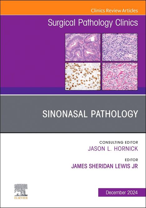 Sinonasal Pathology, an Issue of Surgical Pathology Clinics, Buch