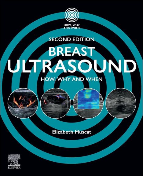"Second Edition: Breast Ultrasound, How, Why and When, Elizabeth Muscat." Hintergrund mit blauen Kreisen und Ultraschallbildern.