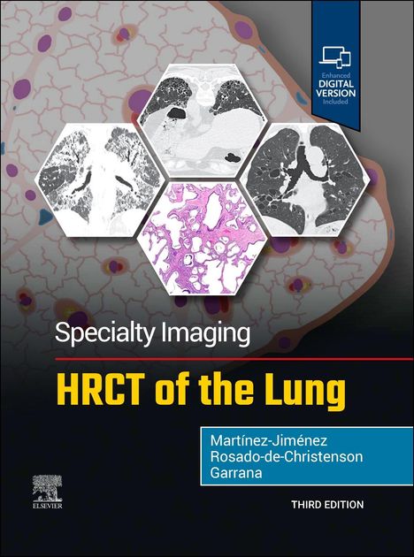 Santiago Martínez-Jiménez: Specialty Imaging: Hrct of the Lung, Buch