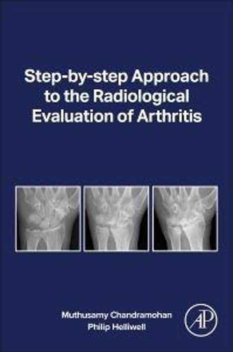 Titel: "Step-by-step Approach to the Radiological Evaluation of Arthritis". Drei Röntgenbilder und Namen: Muthusamy Chandramohan, Philip Helliwell.