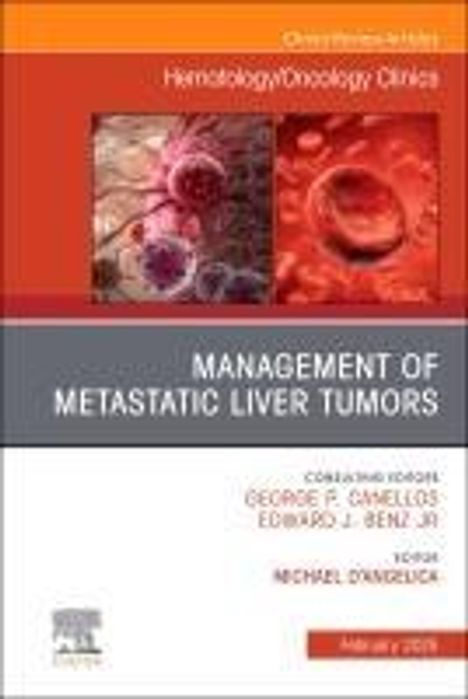 Management of Metastatic Liver Tumors, an Issue of Hematology/Oncology Clinics of North America, Buch