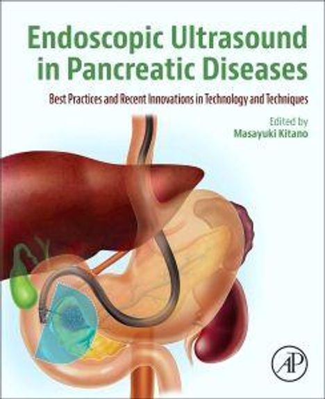 "Endoscopic Ultrasound in Pancreatic Diseases" zeigt Organe und medizinische Geräte.