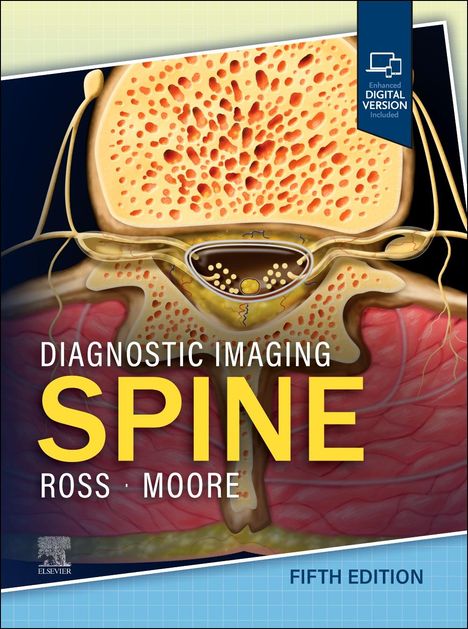 Jeffrey S Ross: Diagnostic Imaging: Spine, Buch