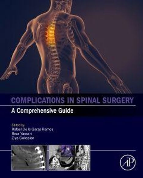 "Complications in Spinal Surgery: A Comprehensive Guide. Edited by Rafael De la Garza Ramos, Rios Vincent, Ziya Gokaslan."