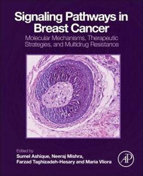 Text: "Signaling Pathways in Breast Cancer: Molecular Mechanisms, Therapeutic Strategies, and Multidrug Resistance." 

Darunter eine mikroskopische Aufnahme von Gewebe. Autoren sind unten aufgeführt.