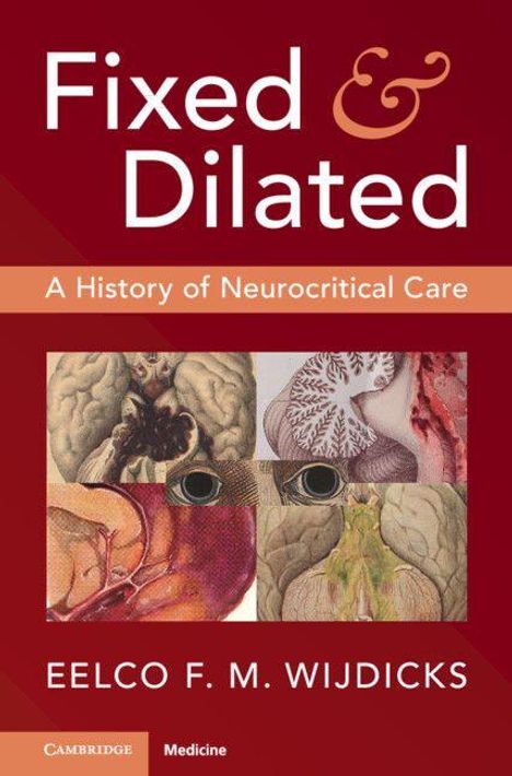 „Fixed & Dilated“, „A History of Neurocritical Care“, „Eelco F. M. Wijdicks“, medizinische Illustrationen des Gehirns.