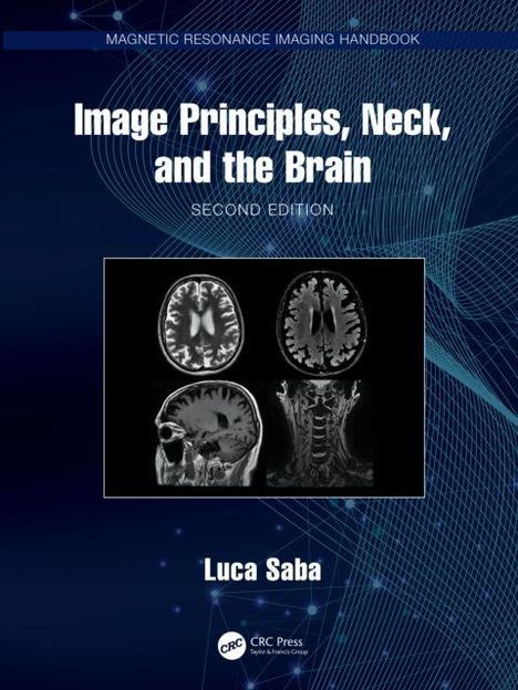 "Image Principles, Neck, and the Brain, Second Edition. Luca Saba." Vier MRT-Bilder des Gehirns und Nackens auf dunklem Hintergrund.