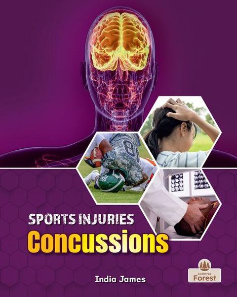 "Sports Injuries: Concussions" von India James. Illustration mit Gehirn, Sportler, einer Person mit Kopfschmerzen und Arztbesuch.