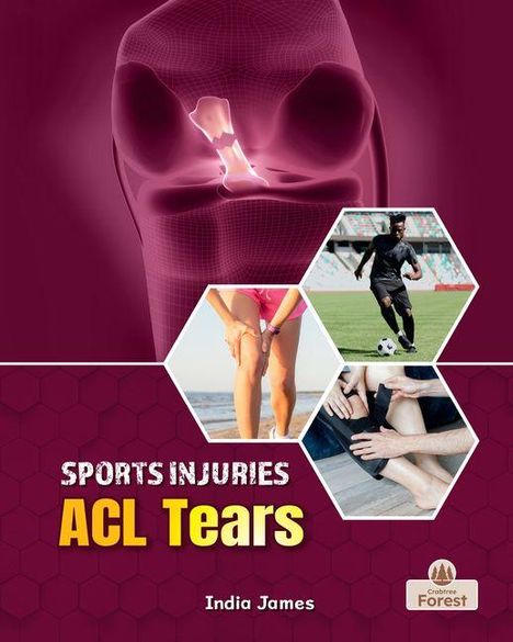 "Sports Injuries: ACL Tears" und "India James". Illustration eines Knies und Sportbilder. Hexagon-Muster, Logo unten rechts.